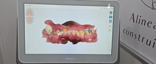 Itero Element 2 (2019)