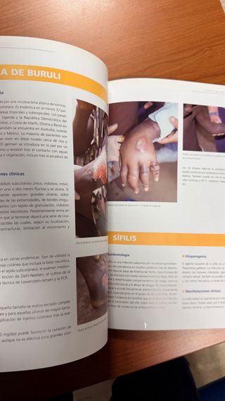 Atlas de dermatología de la piel negra