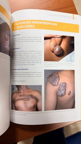 Atlas de dermatología de la piel negra