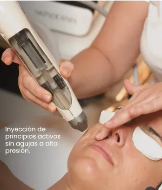 Aparatologia estética avanzada facial