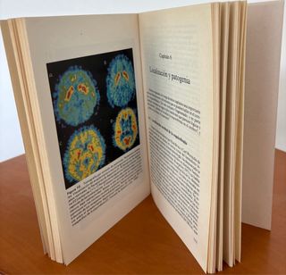 Esquizofrenia por Jordi E. Obiols y Joan Obiols