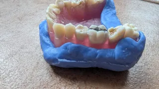 Tipodonto Dientes Naturales