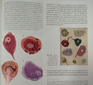 Neurología. Sistema nervioso. Medicina