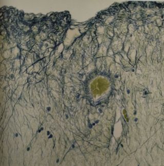 Neurología. Sistema nervioso. Medicina