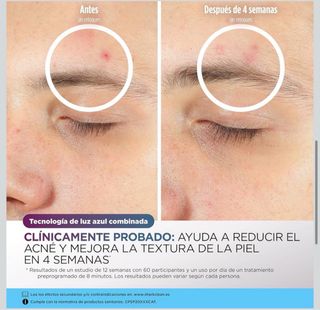 (PRECINTADA) Shark CryoGlow Mascarilla LED y Frío