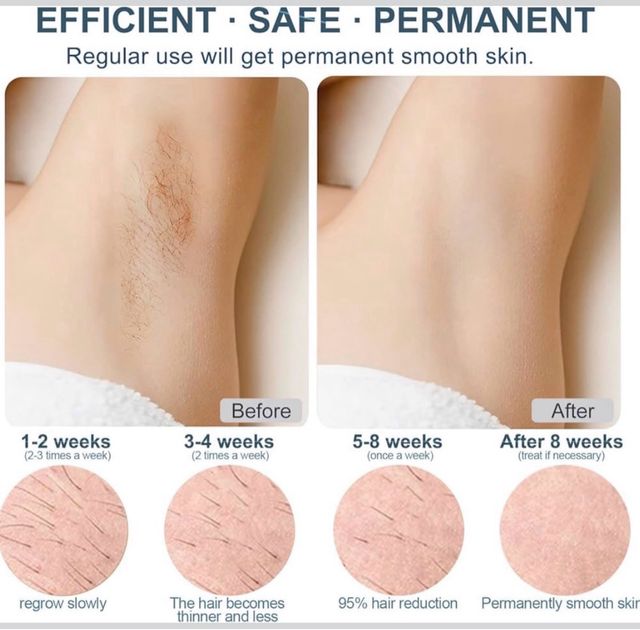 Depiladora Veme V601 IPL con Frío 500000 Pulsos