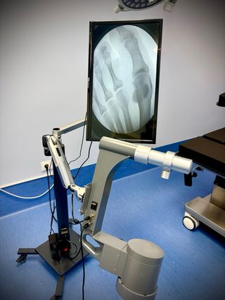 Fluoroscopio Bojin - Como Nuevo