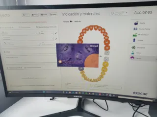 Asesoría Técnica Especializada Exocad