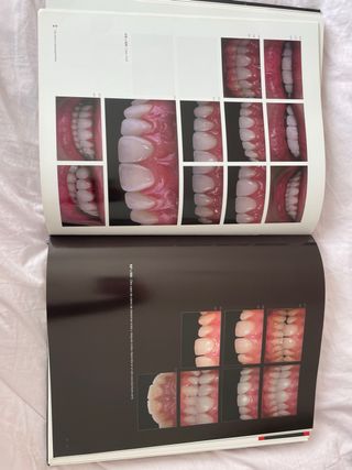 Tips claves en odontología estética