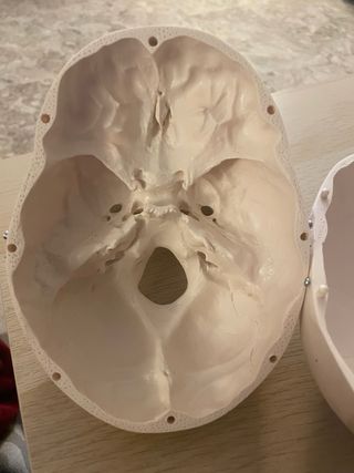 Cráneo Humano Clásico 3B Scientific GMBh Medicina