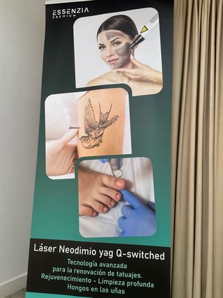 Eliminación de tatuajes con tecnología avanzada