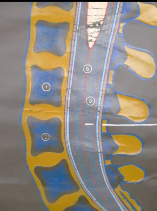 Tabla médica polaca 1950-1960, en cuero artificial