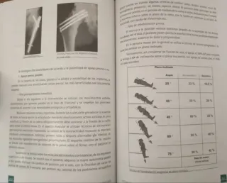 Manual Traumatología