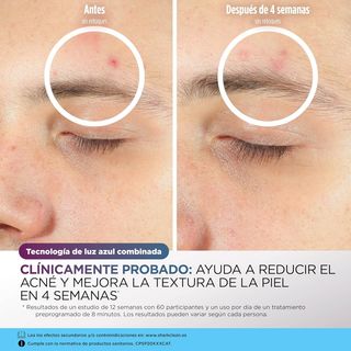 Shark CryoGlow Mascarilla LED Facial Antiedad