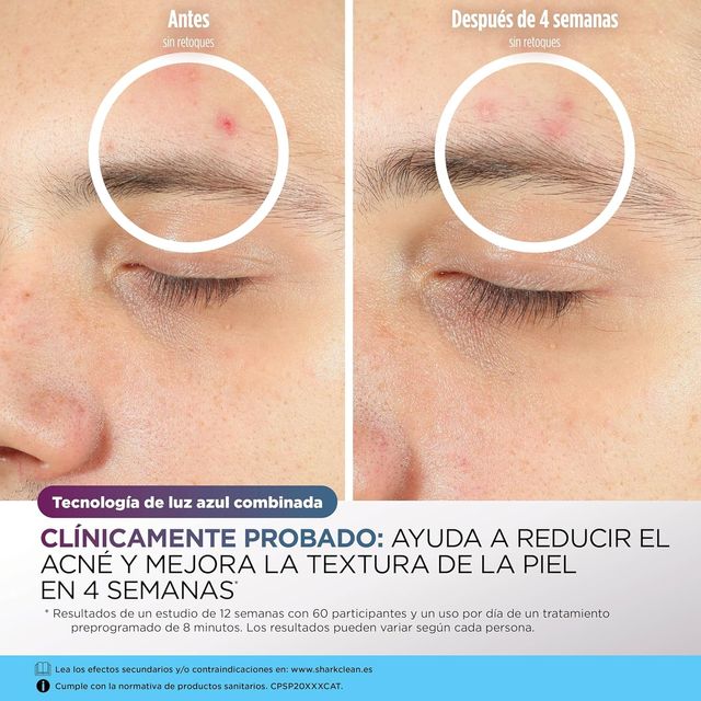 Shark CryoGlow Mascarilla LED Facial Antiedad