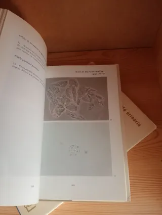 Atlas del sedimento urinario