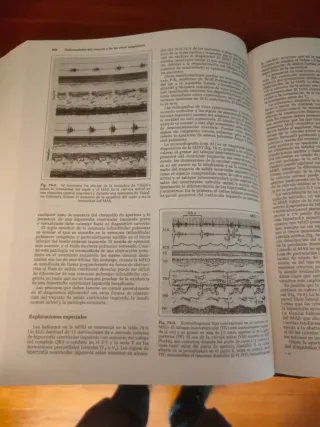 Medicina Interna Jay H. Stein