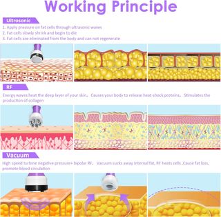 Máquina Radio Frecuencia Profesional