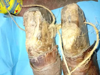 Hormas de zapato antiguas