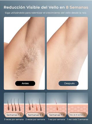 NUEVADepiladora Láser 21J Refrigeración 600-1200NM