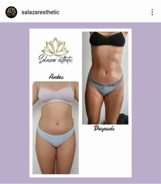 Masaje Reductor/Moldeador/Reafirmante