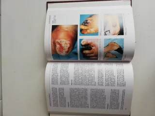 Arteriopatias periféricas