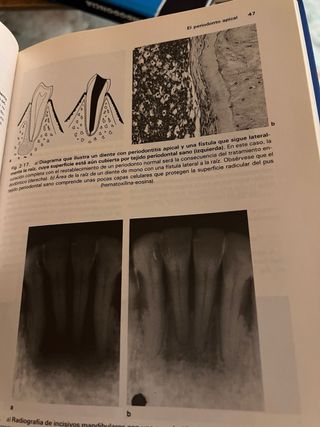 Endodoncia Clínica