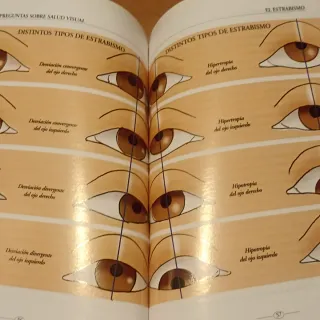 100 preguntas frecuentes sobre salud visual