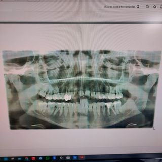 Scanner Brother ADS-2100e