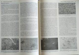 ANATOMÍA PATOLÓGICA. JULIANA FARIÑA.