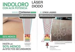 Láser citas 20 de marzo