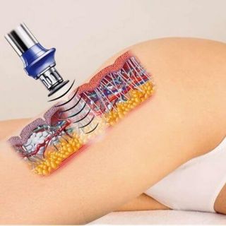 Masaje Post Operatorio, Celulitis, Flacidez