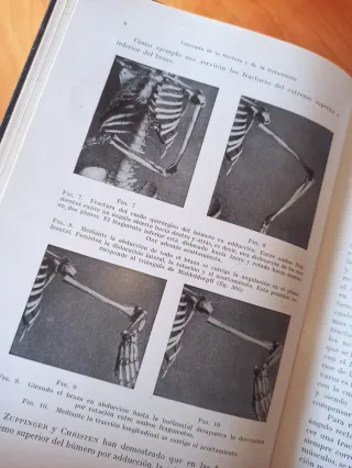 Libro antiguo 1934: Tratamiento de las Fracturas