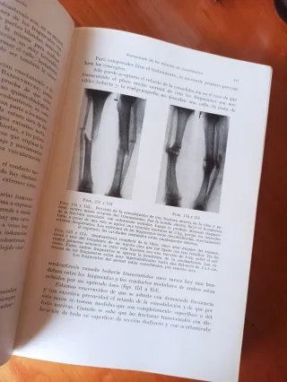 Libro antiguo 1934: Tratamiento de las Fracturas