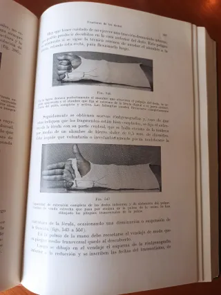 Libro antiguo 1934: Tratamiento de las Fracturas