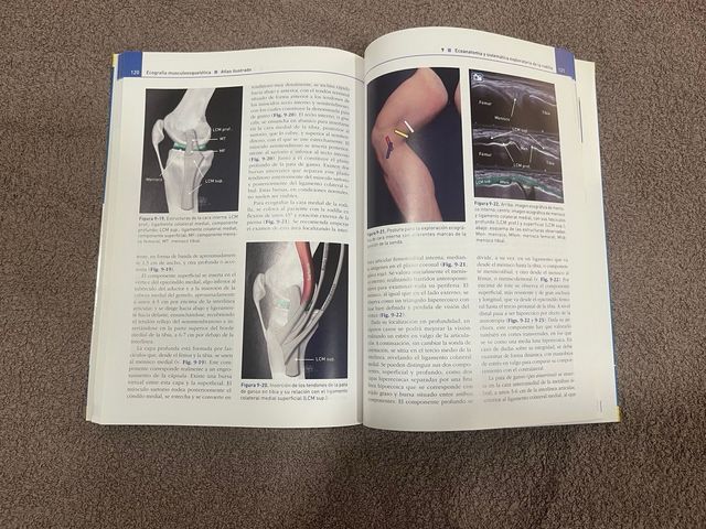 Ecografía musculoesquelética atlas ilustrado