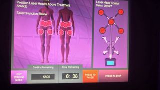 Láser Reductor + formacion protocolo +rentabilidad