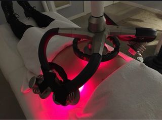 Láser Reductor + formacion protocolo +rentabilidad