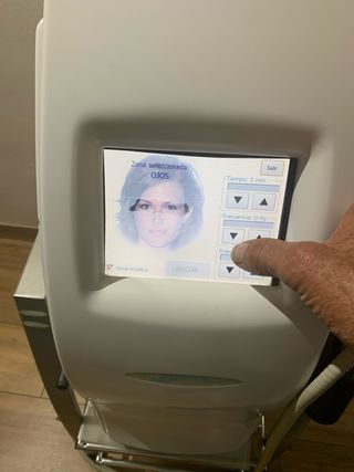 Thermafine Radiofrecuencia