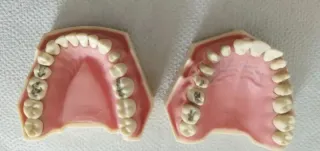 Tipodontos dentales marca Frasaco. AG-3 Y AK-6/2.