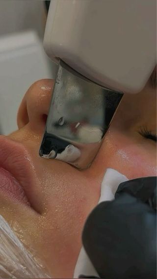 Tratamientos faciales y esteticos
