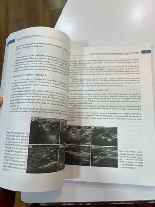 Ecografía musculoesquelética esencial