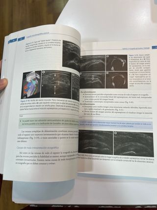 Ecografía musculoesquelética esencial