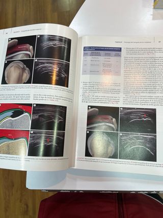 Ecografía Musculoesquelética