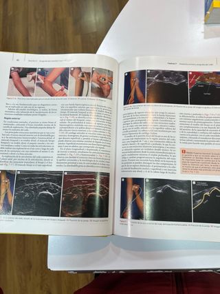 Ecografía Musculoesquelética