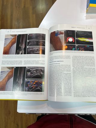 Ecografía Musculoesquelética