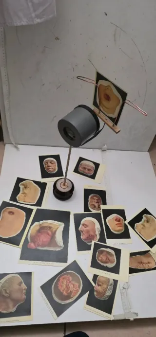 Visore con immagini mediche di malattie