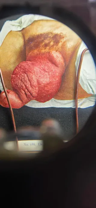 Visore con immagini mediche di malattie