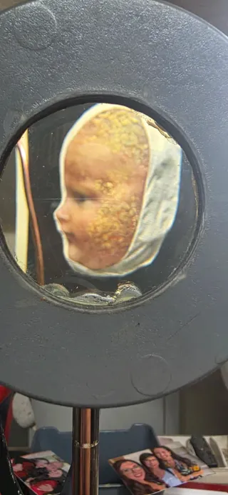 Visore con immagini mediche di malattie