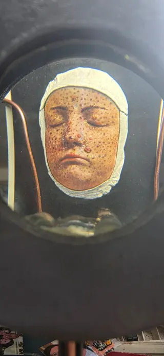 Visore con immagini mediche di malattie